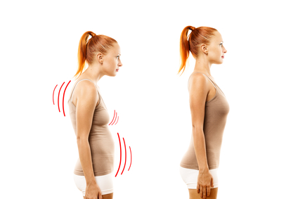 Women with Poor Posture